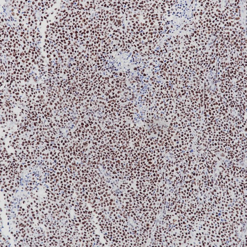 FOXP1 Rabbit Monoclonal Antibody(ARB861)