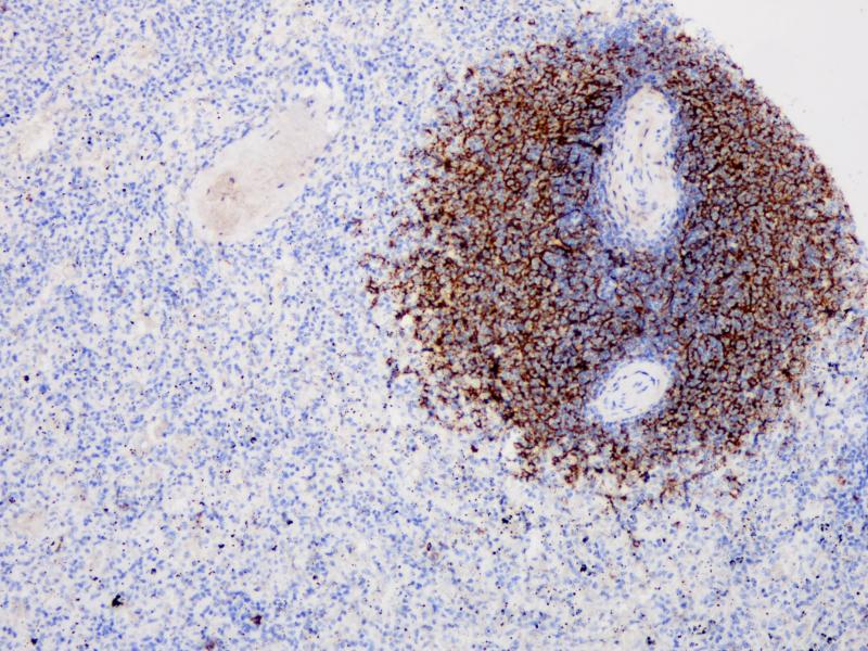 CD21 Rabbit Monoclonal Antibody(ARB898)
