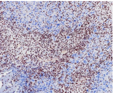SNF5 Rabbit Monoclonal Antibody(ARB548)