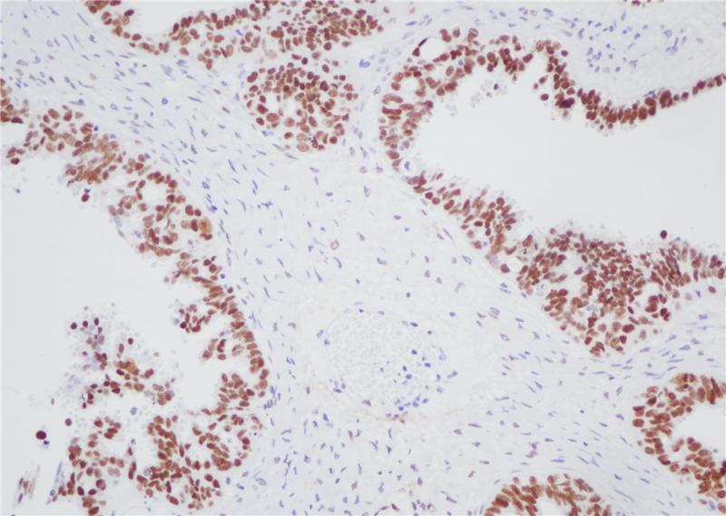WT1 Rabbit Monoclonal Antibody(ARB572)