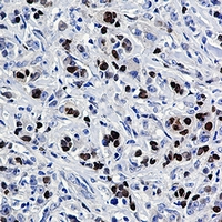 SOX9 Rabbit Monoclonal Antibody(ARA829)