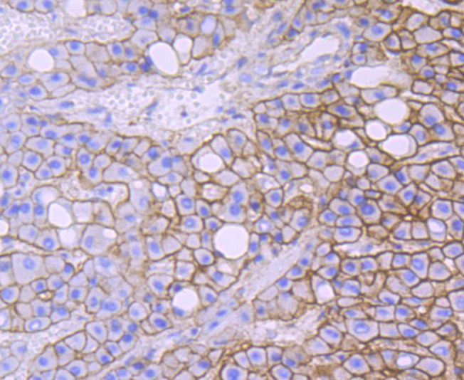 Spectrin Rabbit Monoclonal Antibody(ARA894)