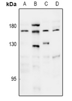 Thrombospondin 1 Rabbit Polyclonal Antibody