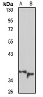 TaR-1 Rabbit Polyclonal Antibody