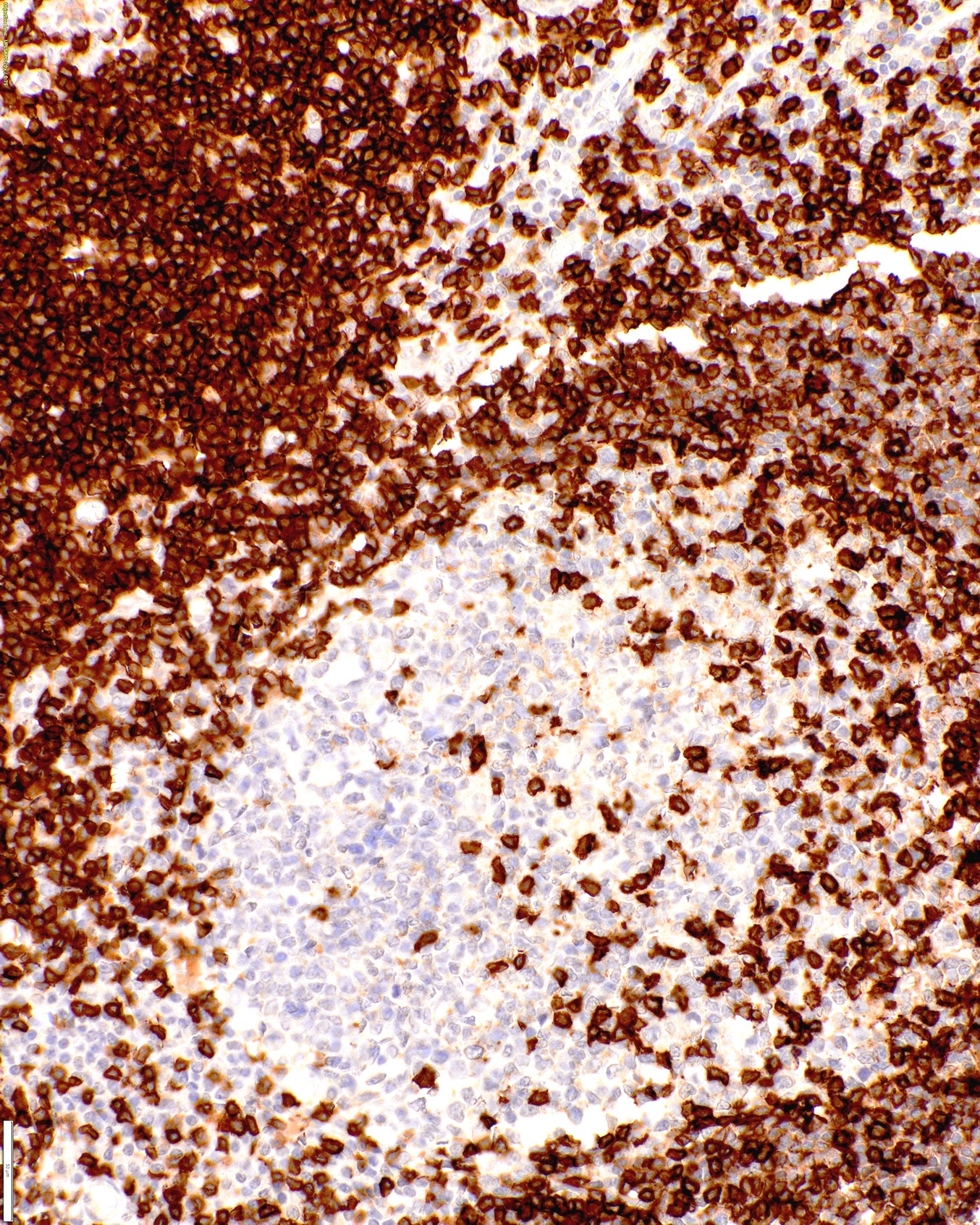 CD5 Rabbit Monoclonal Antibody(ARM897)