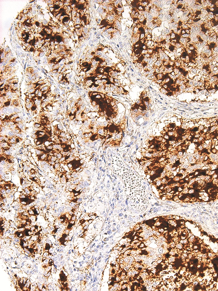 BG8, Lewis y Mouse Monoclonal Antibody(ARM929)