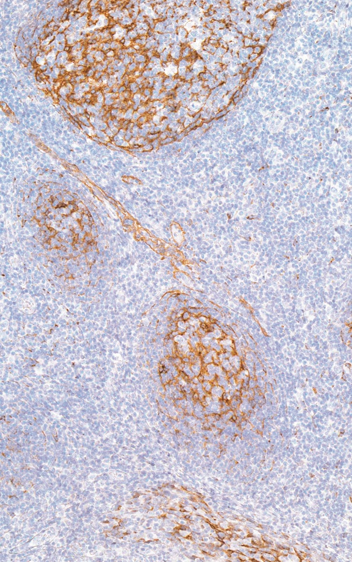 Clusterin/Apolipoprotein J Rabbit Monoclonal Antibody(ARM966)