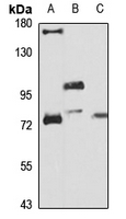 PLOD3 Rabbit Polyclonal Antibody