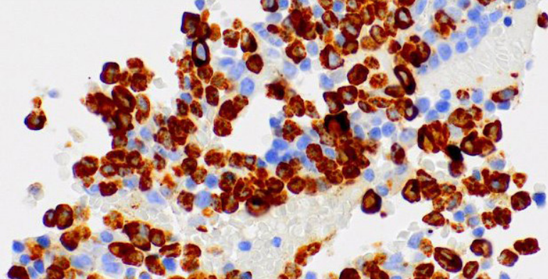 Myeloperoxidase Rabbit Monoclonal Antibody(ARM531)