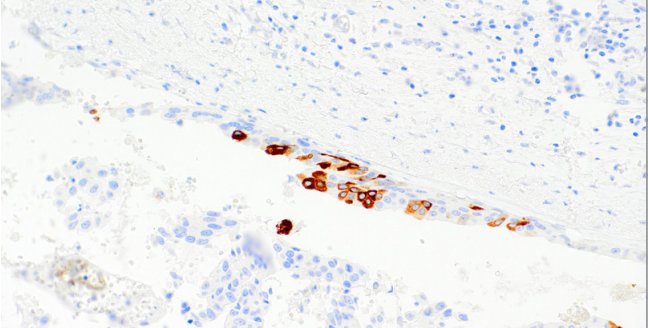 Mammaglobin Rabbit Monoclonal Antibody(ARM522)