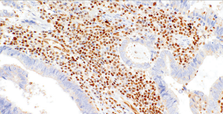 Fli-1 Rabbit Monoclonal Antibody(ARM617)