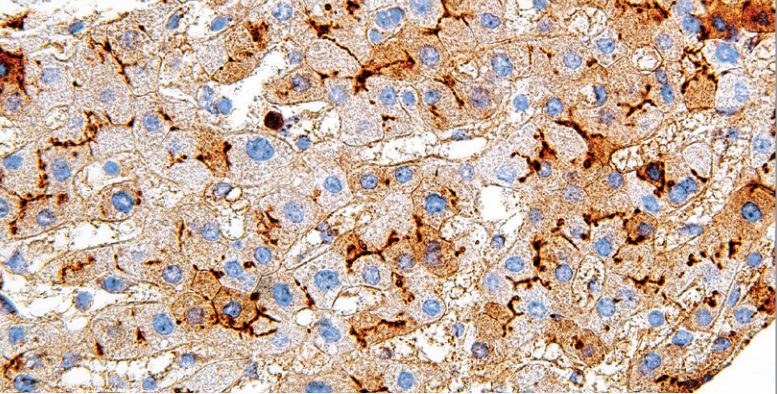 CD13 Rabbit Monoclonal Antibody(ARM603)
