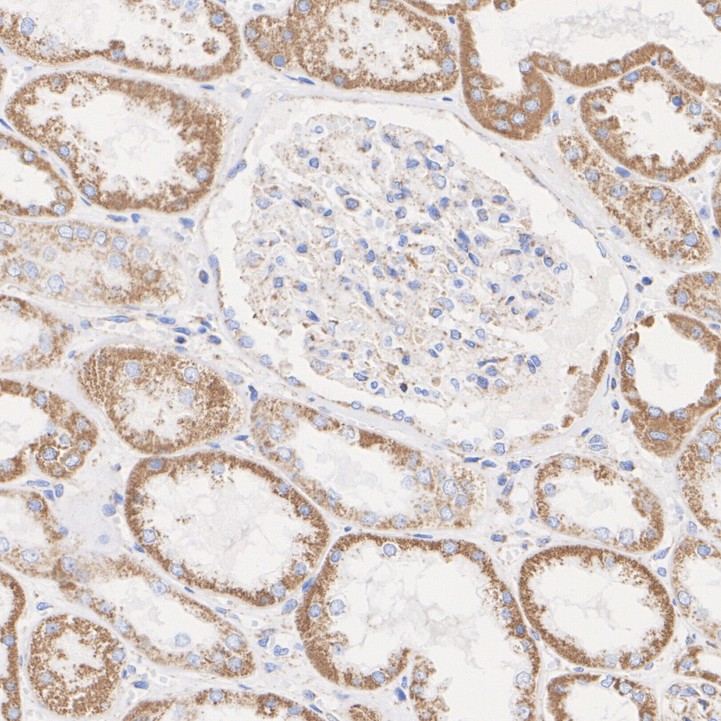 SDHA Rabbit Monoclonal Antibody(ARA900)