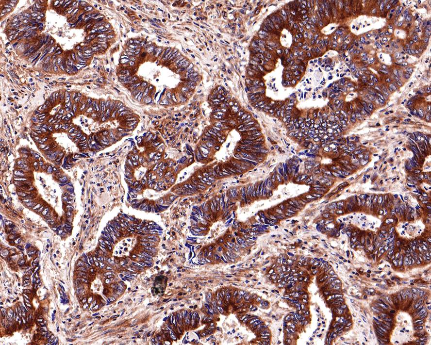 Tubulin-&beta; Rabbit Monoclonal Antibody(ARA907)