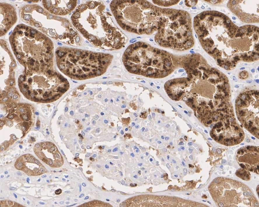 FHIT Rabbit Monoclonal Antibody(ARA905)
