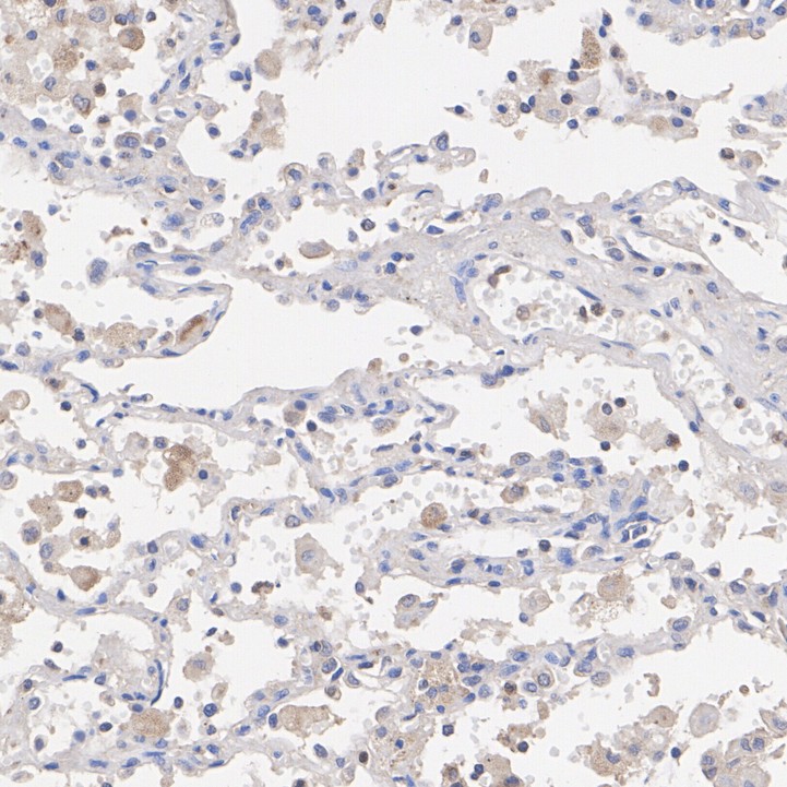 DNP Rabbit Monoclonal Antibody(ARA904)