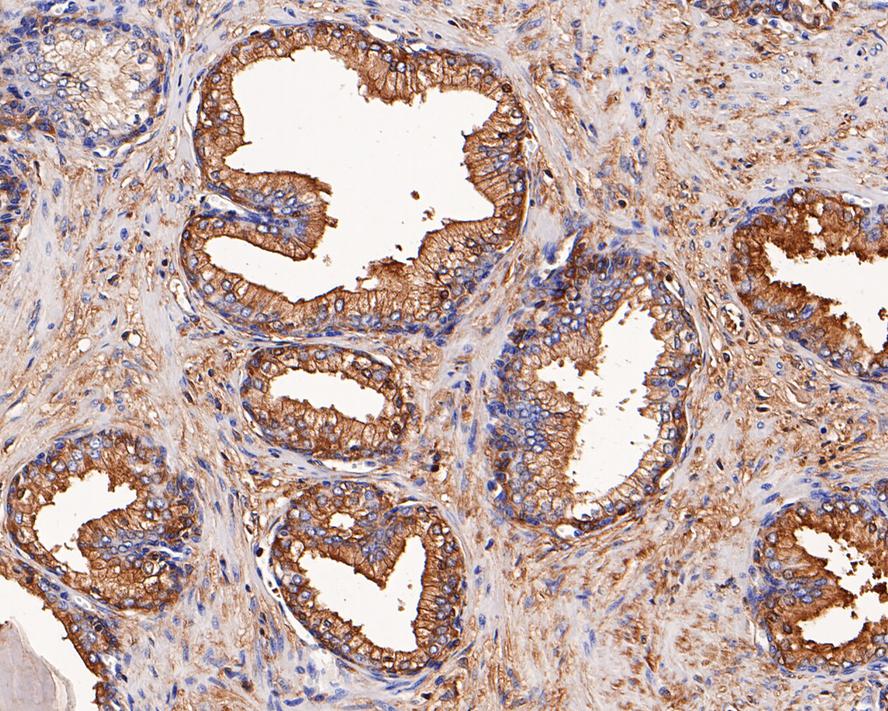 AACT Rabbit Monoclonal Antibody(ARA898)