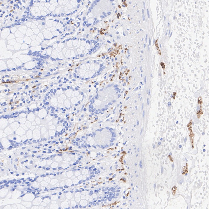 VIP Rabbit Monoclonal Antibody(ARA932)