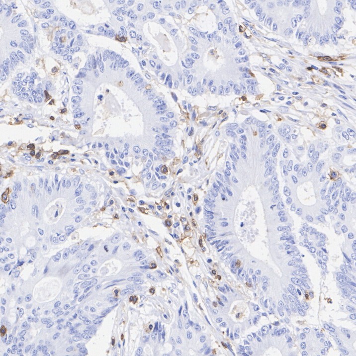 CD45RO&nbsp;Mouse&nbsp;Monoclonal&nbsp;Antibody(ARA936)&nbsp;
