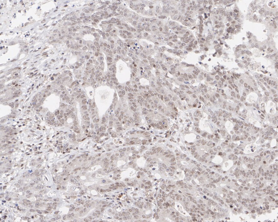BRM Rabbit Monoclonal Antibody(ARA929)