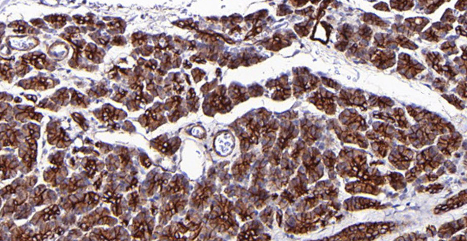 Claudin-4 Mouse Monoclonal Antibody(ARA926)