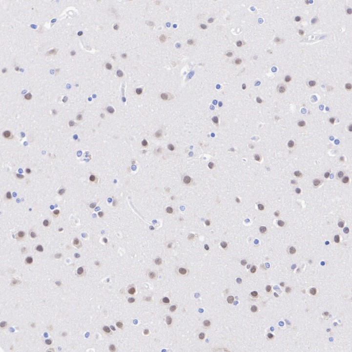 MEF2C Rabbit Monoclonal Antibody(ARA940)