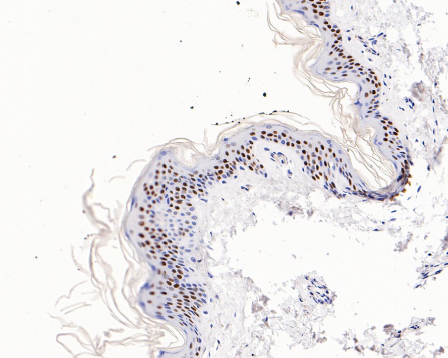 p63 Rabbit Monoclonal Antibody(ARA944)