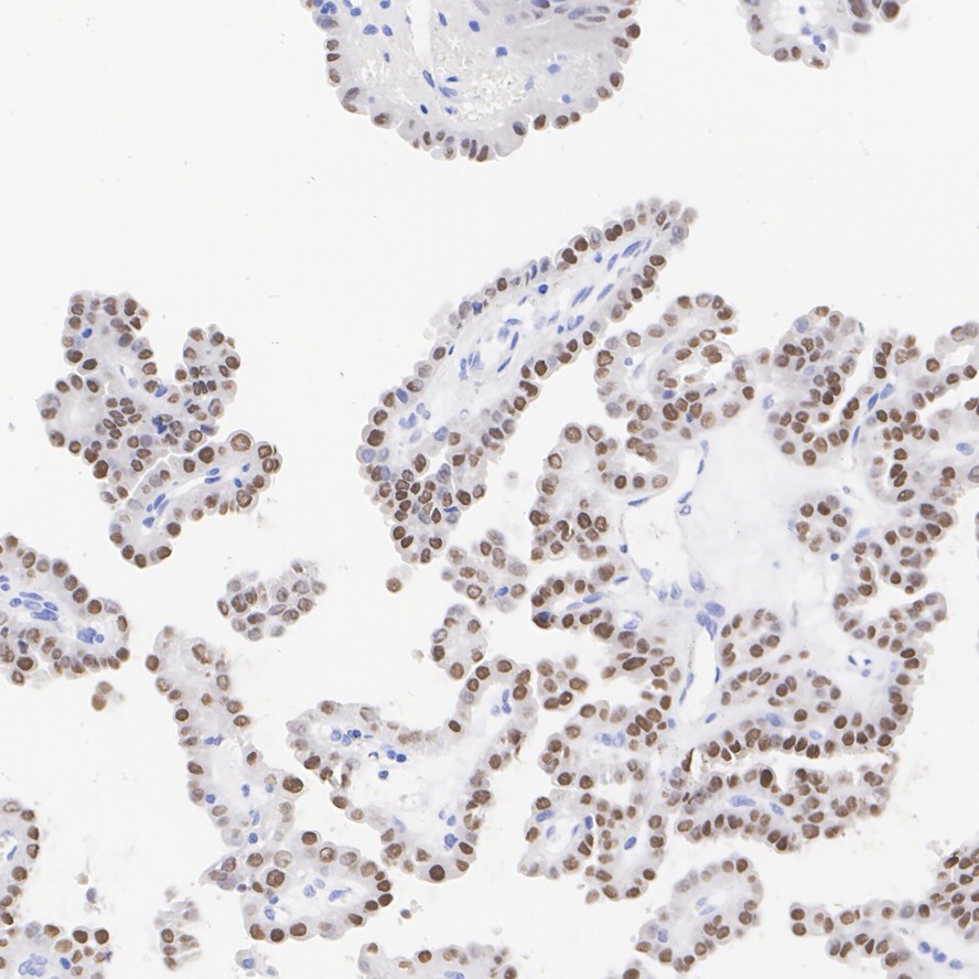 TTF1 Rabbit Monoclonal Antibody(ARA942)