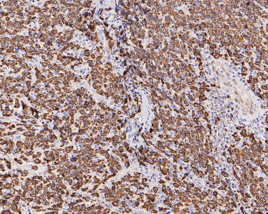 BCL-2 Rabbit Monoclonal Antibody(ARA941)