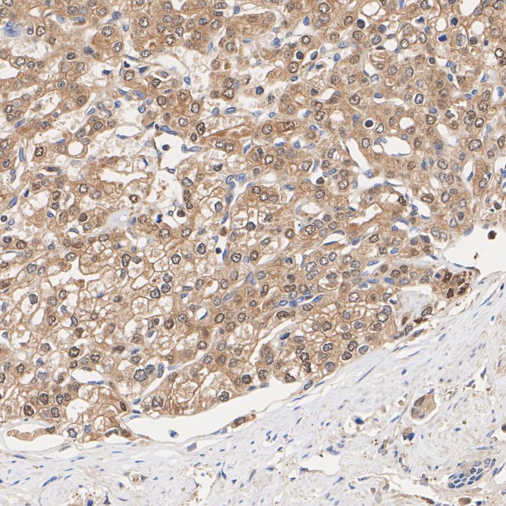 IDH1 Rabbit Monoclonal Antibody(ARA946)
