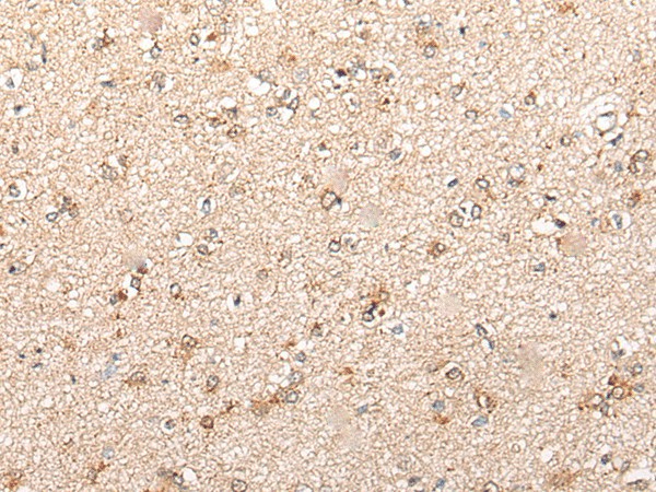 CYP11B2 Rabbit Polyclonal Antibody