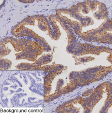 STEAP1 Mouse Monoclonal Antibody(ARA947)