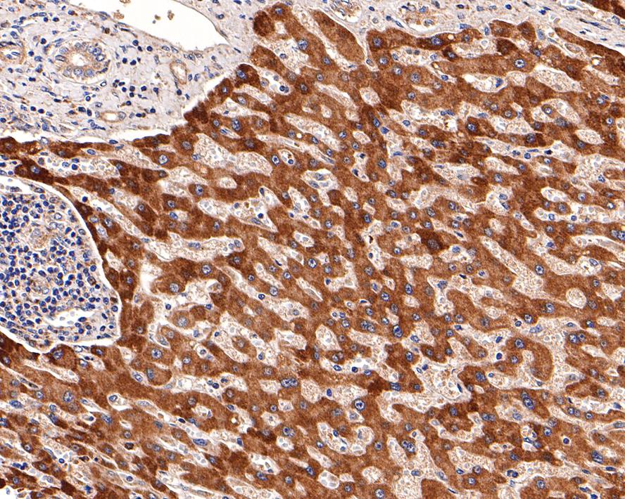 ADFP/PLIN2 Rabbit Monoclonal Antibody(ARA938)