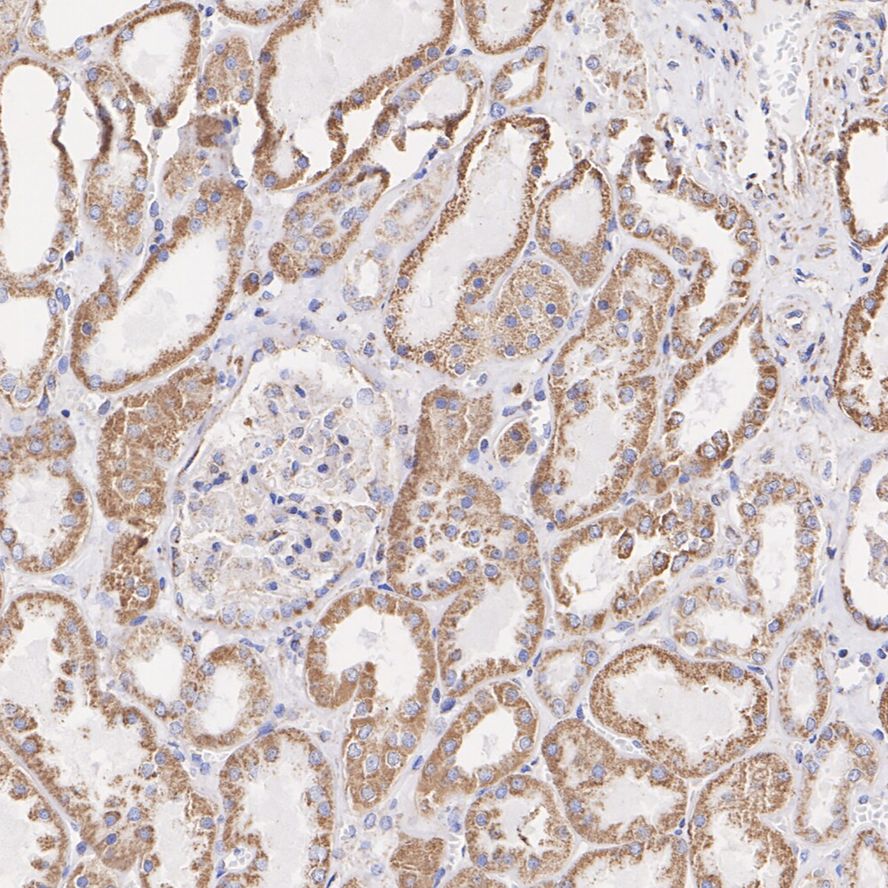 SDHB Rabbit Monoclonal Antibody(ARA951)