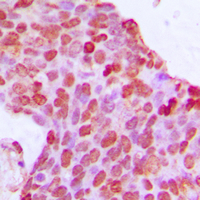 BCOR Rabbit Polyclonal Antibody