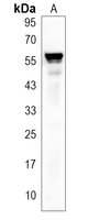 Cytochrome P450 7A1 Rabbit Polyclonal Antibody