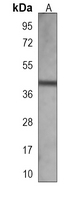FAT4 Mouse Monoclonal Antibody(ARA948)