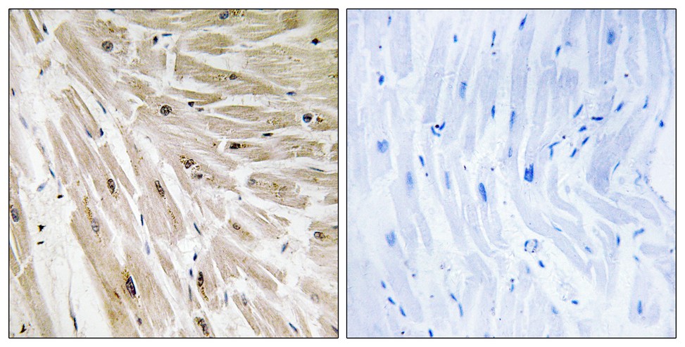 EBER/Ribosomal Protein L22 Rabbit Polyclonal Antibody