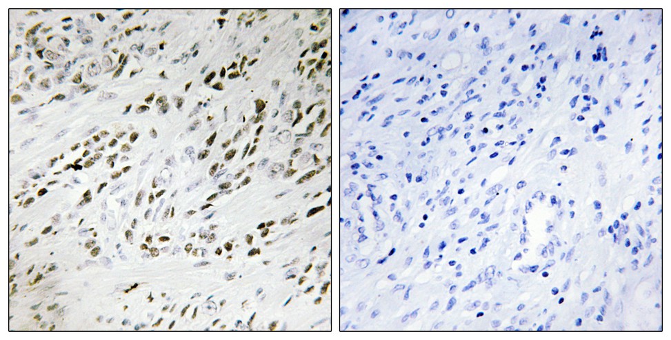 TSHZ2 Rabbit Polyclonal Antibody