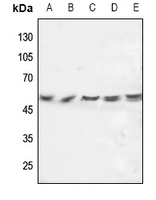 FGL2 Rabbit Polyclonal Antibody