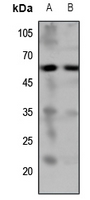 5-HT7 Rabbit Polyclonal Antibody