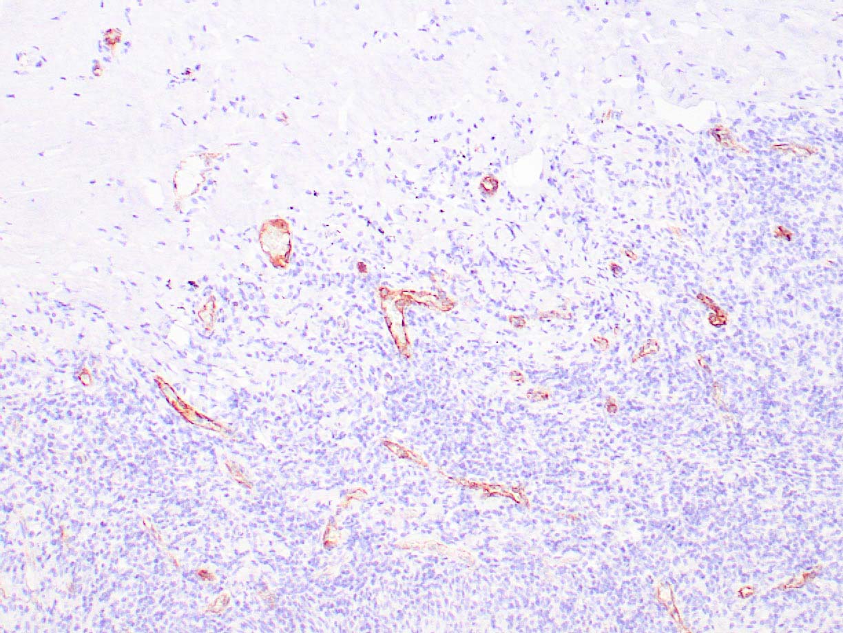 Factor VIII Mouse Monoclonal Antibody(ARA969)