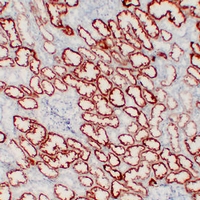 pVHL Mouse Monoclonal Antibody(ARA966)