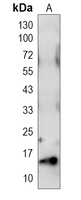 CCL8 Rabbit Polyclonal Antibody