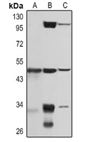 Adipophilin Rabbit Polyclonal Antibody