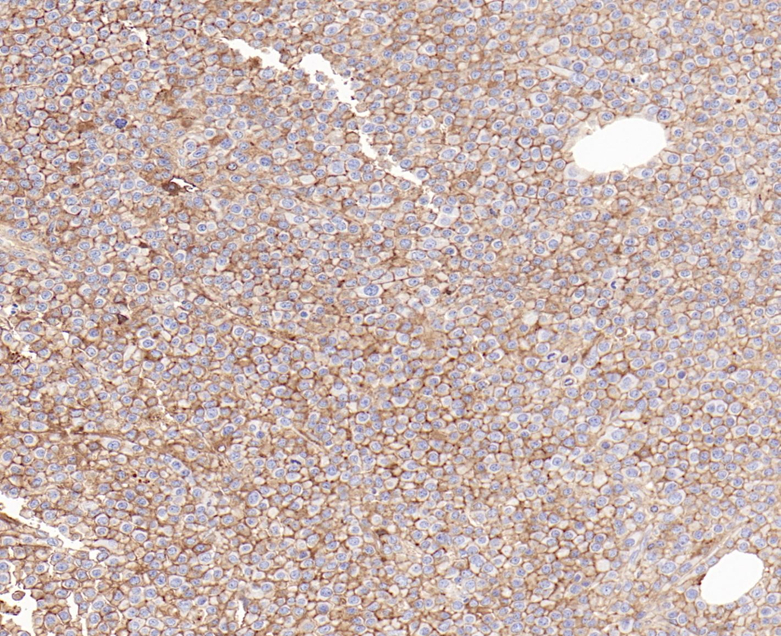 CD138 Rabbit Monoclonal Antibody(ARB586)