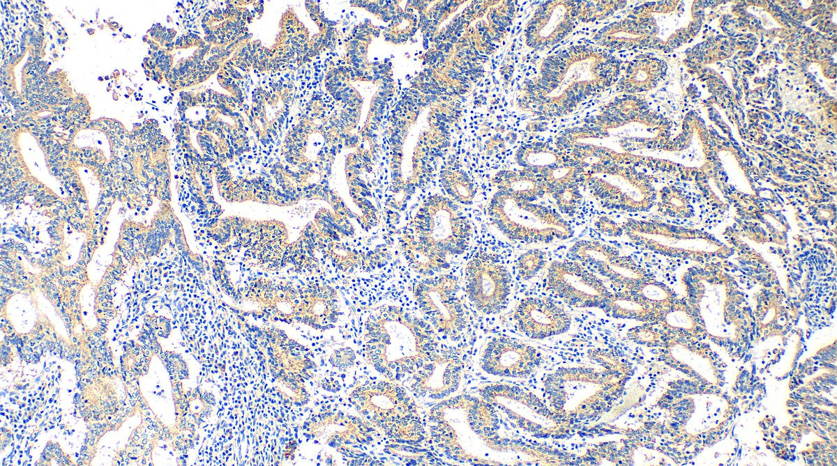 Claudin 9 Rabbit Polyclonal Antibody