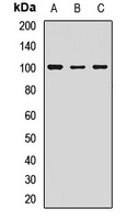 LGR5/GPR49 Rabbit Polyclonal Antibody