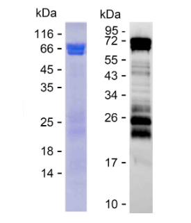 Phosphorylated Recombinant Human Tau Protein