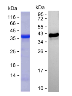 Recombinant Human Tau Protein